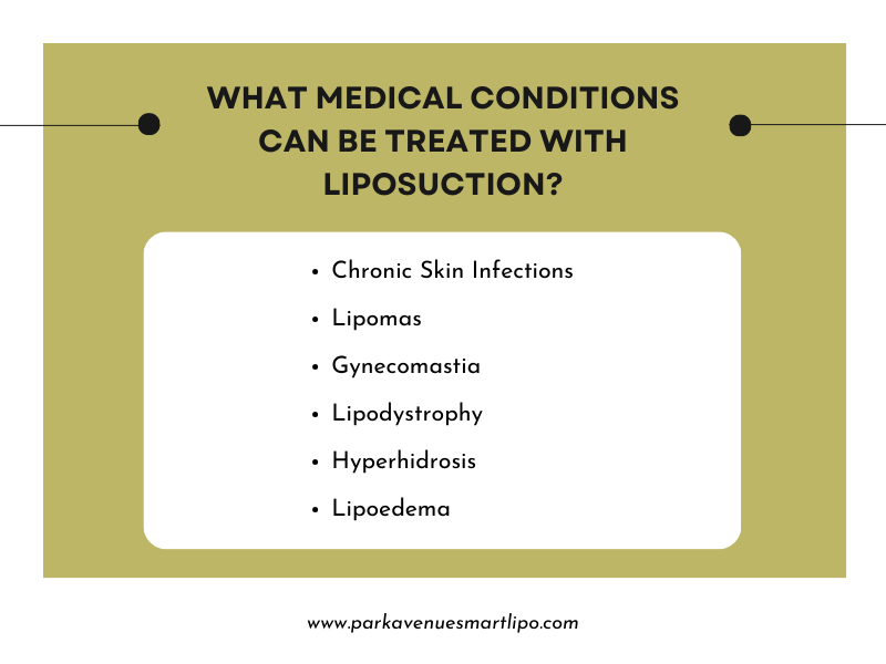 Liposuction
