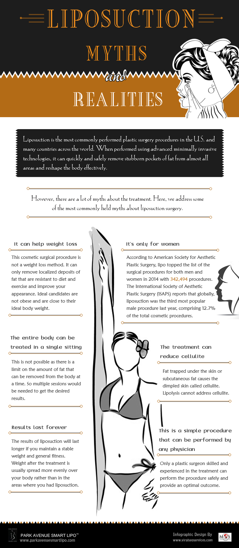 Liposuction Myths and Realities