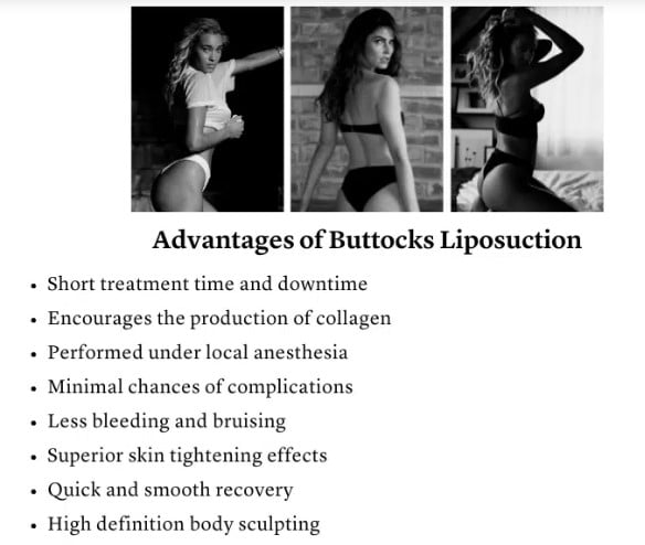 buttocks liposuction
