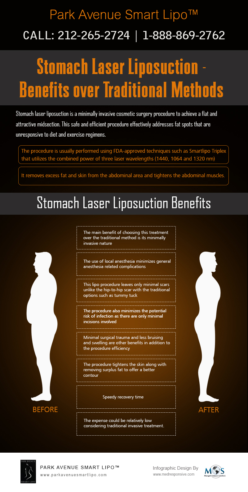 Stomach Laser Liposuction vs. Traditional Methods