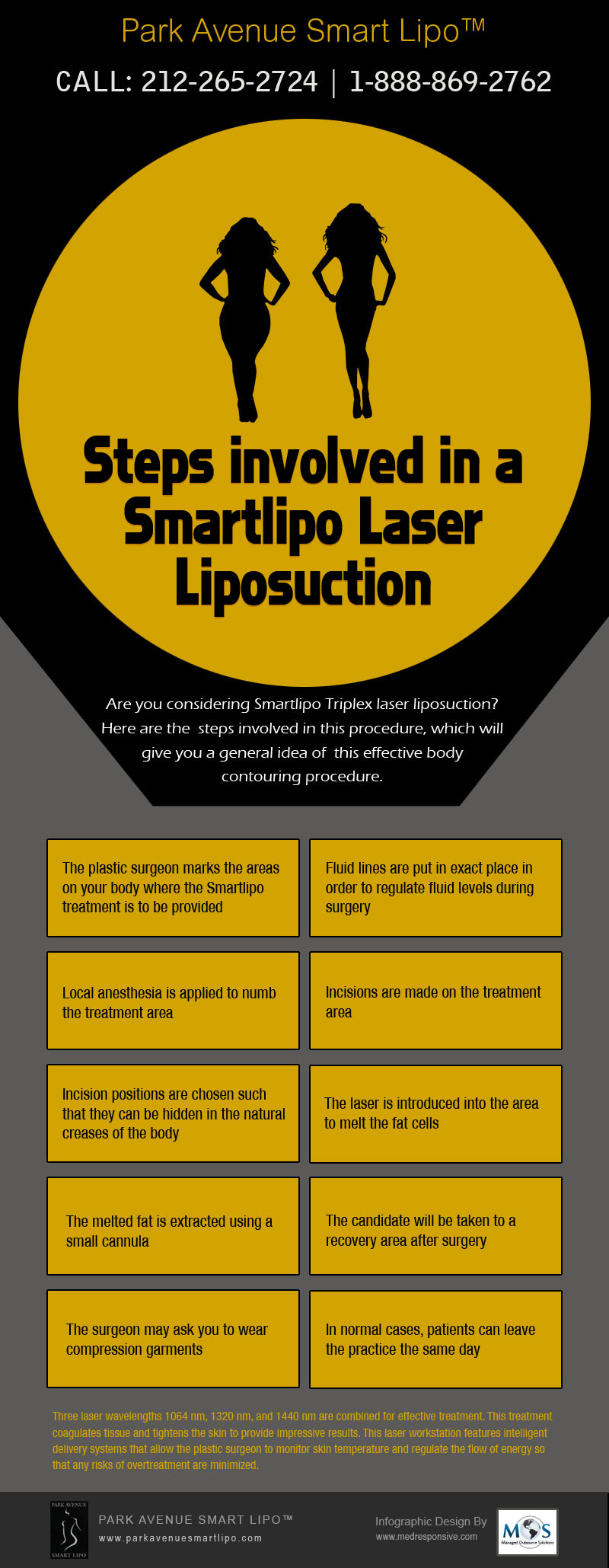 Smartlipo Laser Liposuction