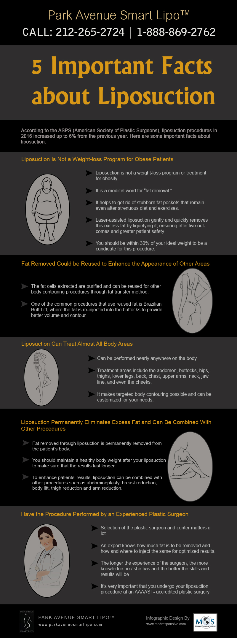 Liposuction