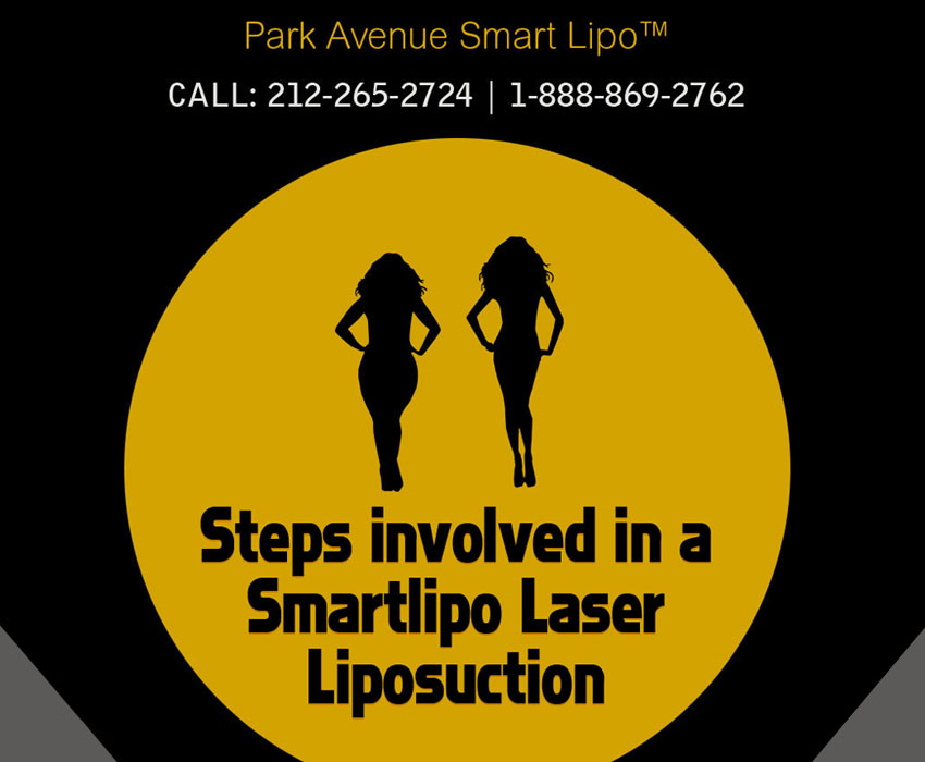 Steps involved in a Smartlipo Laser Liposuction