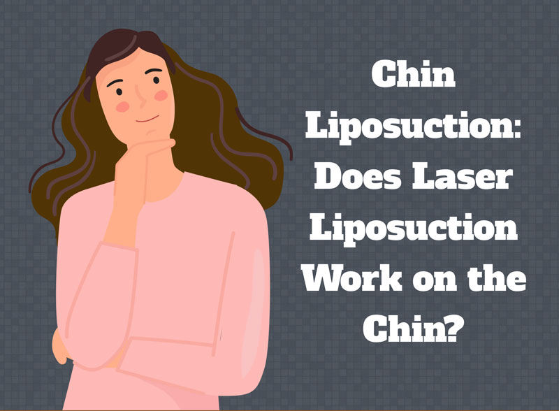 Chin Liposuction: Does Laser Liposuction Work on the Chin? [Infographic]