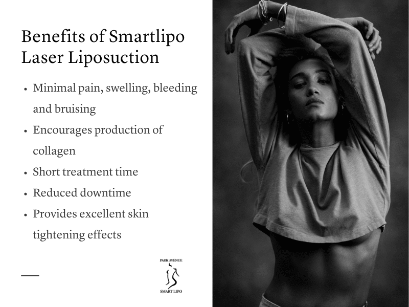 Smartlipo Laser Liposuction