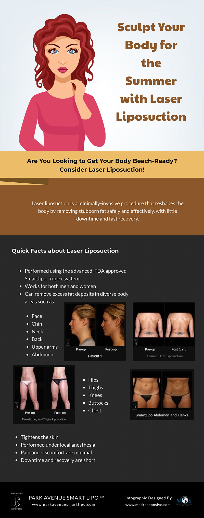 Laser Liposuction