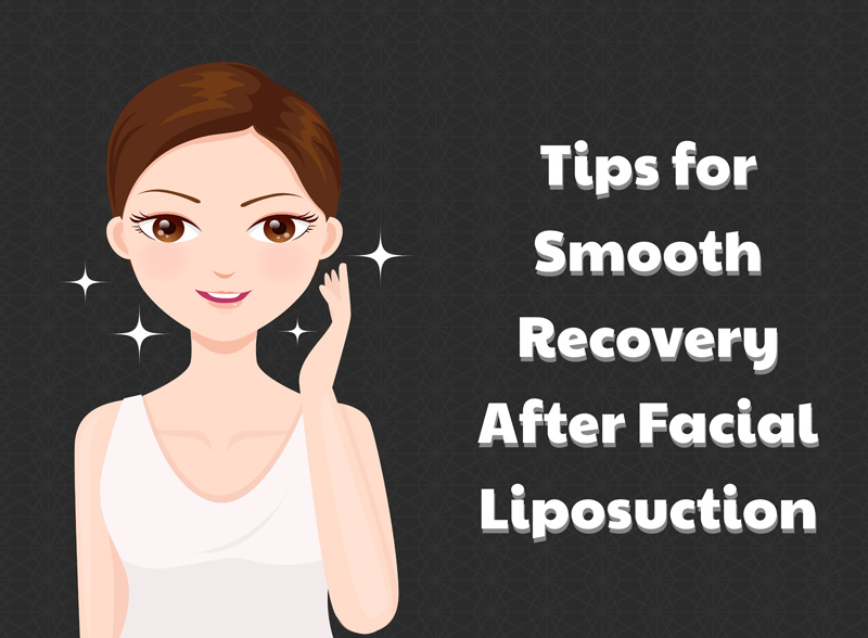 Facial Liposuction Tips for Smooth Recovery [Infographic]