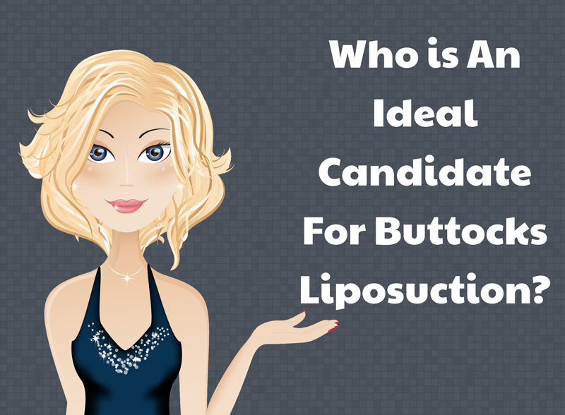 Who Is An Ideal Candidate For Buttocks Liposuction? [Infographic]
