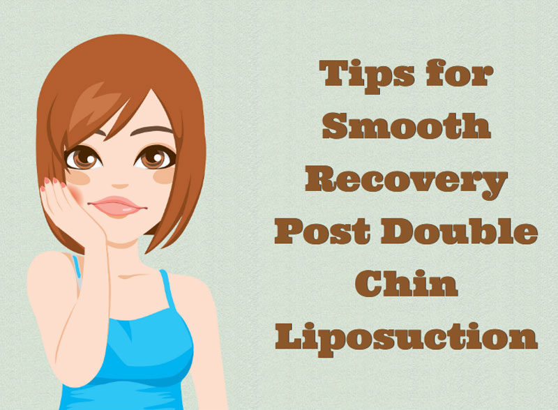 Tips For Smooth Recovery Post Double Chin Liposuction [Infographic]