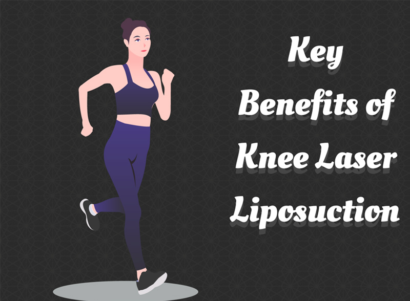 Key Benefits Of Knee Laser Liposuction [Infographic]