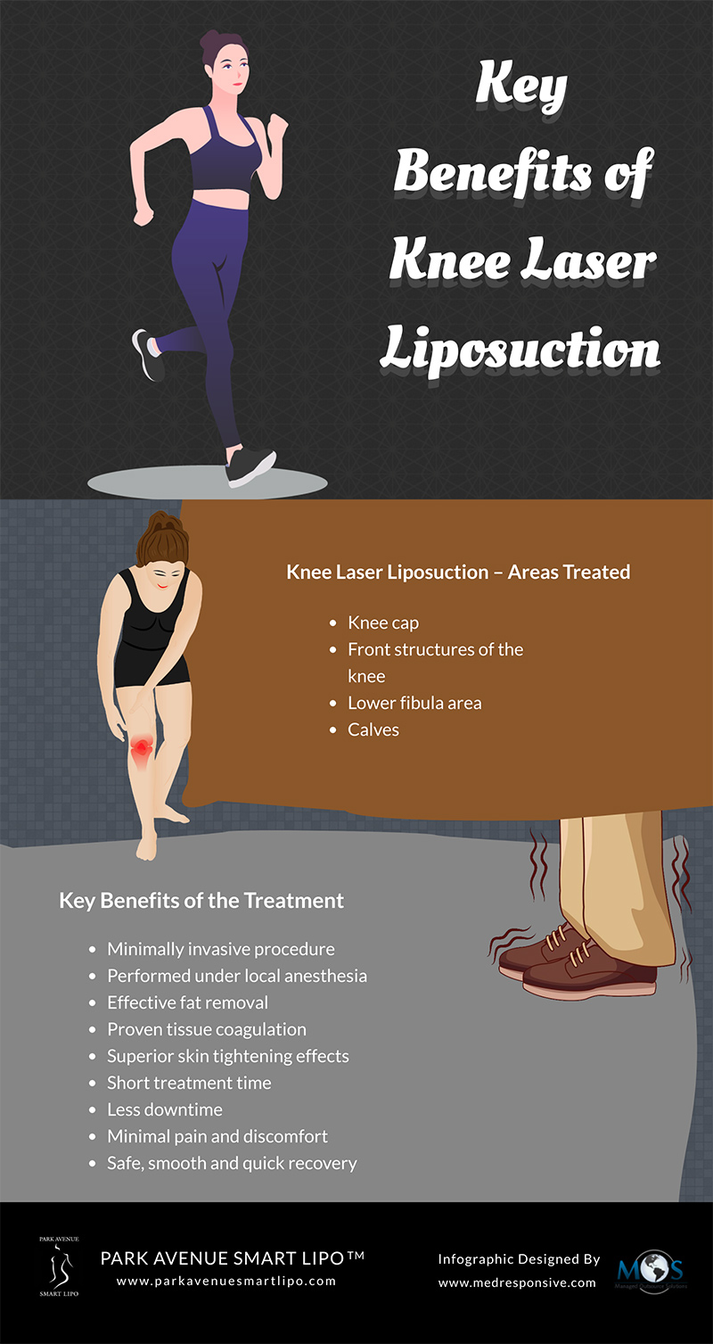 Knee Laser Liposuction