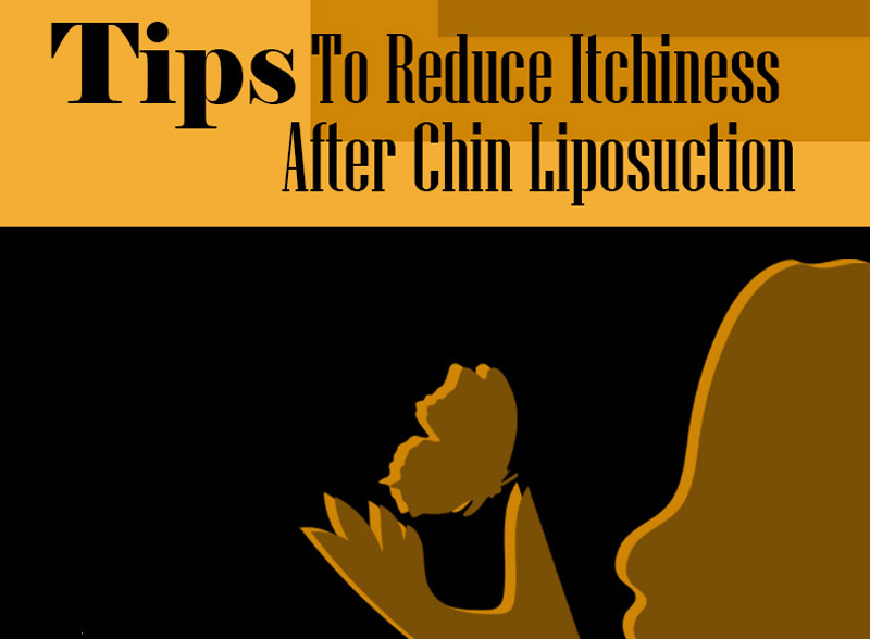 Tips To Reduce Itchiness After Chin Liposuction [Infographic]