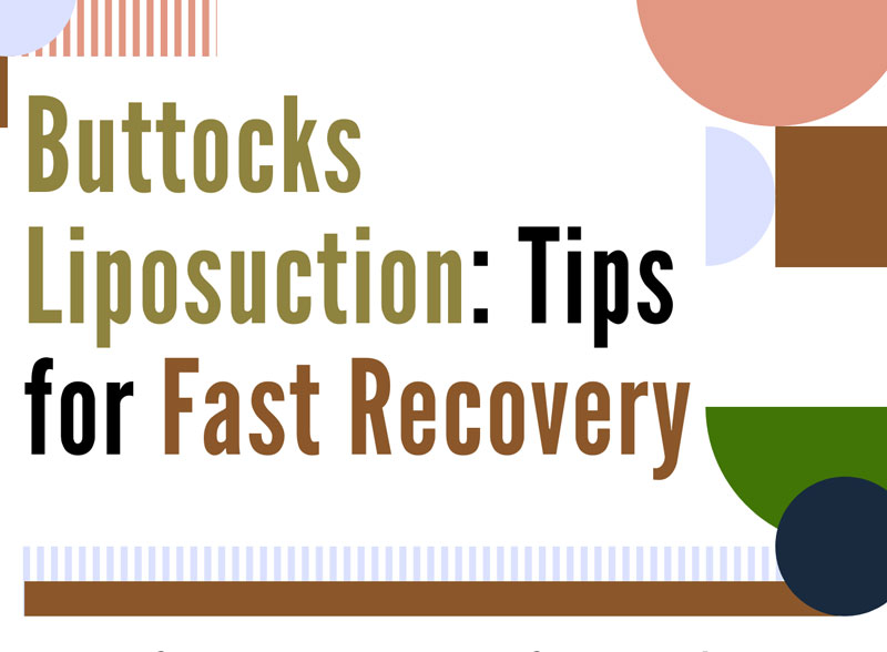 Buttocks Liposuction: Tips For Fast Recovery [Infographic]