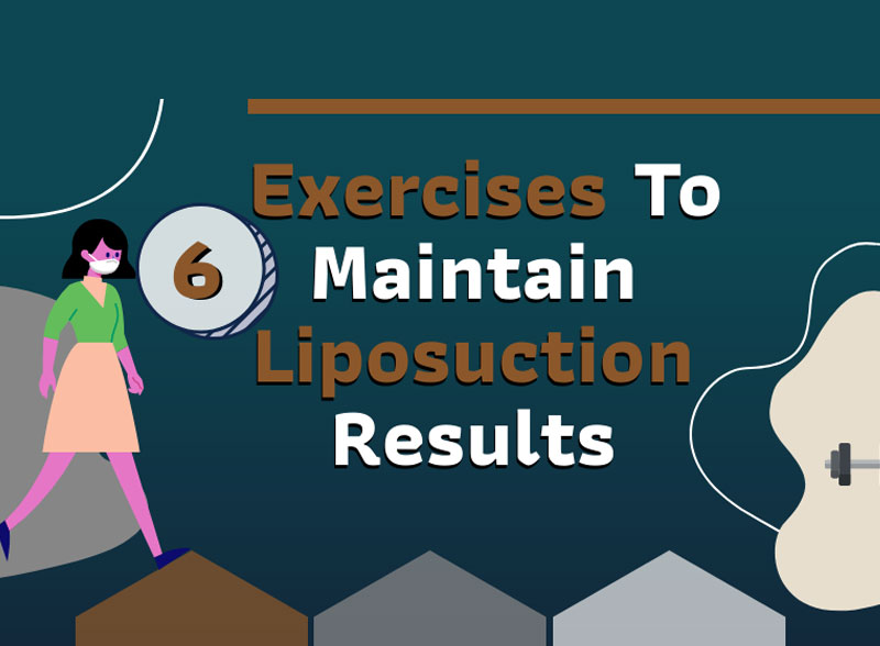 6 Exercises To Maintain Liposuction Results [Infographic]