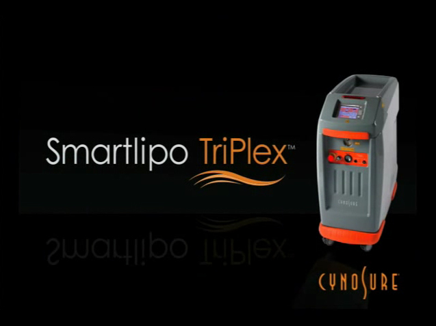 SmartLipo Triplex High Definition Laser Liposuction Video