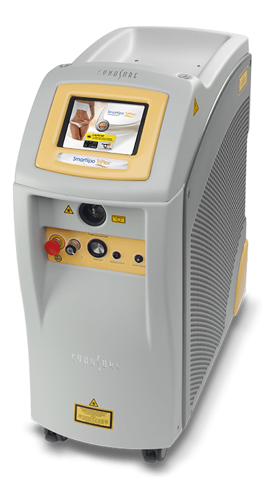 Smartlipo Triplex Smartlipo Triplex