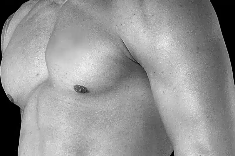 What are the Key Benefits of Hi Def Liposuction NYC?