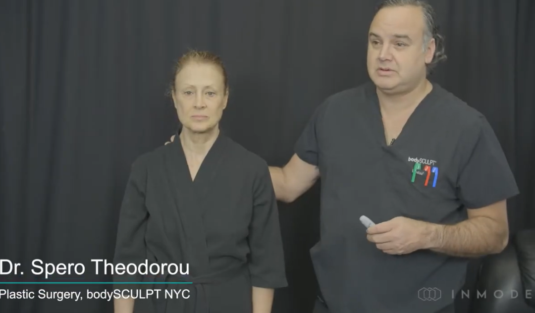Dr. Spero Theodorou Performs AccuTite and Morpheus8 on the Face