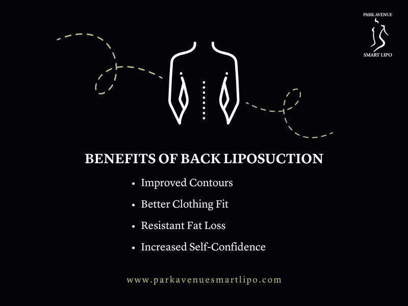 What are the Advantages of Back Fat Liposuction in NYC