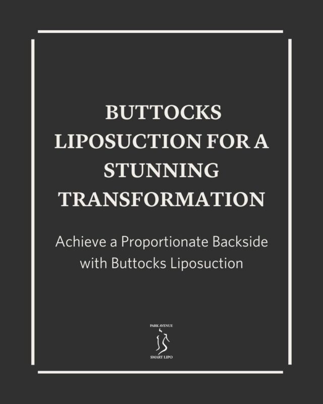 Are you fed up with your sagging/bulging buttocks? 
Our Buttocks Liposuction slims and sculpts for a smoother, more contoured look and helps regain your confidence. Schedule your appointment with us today!